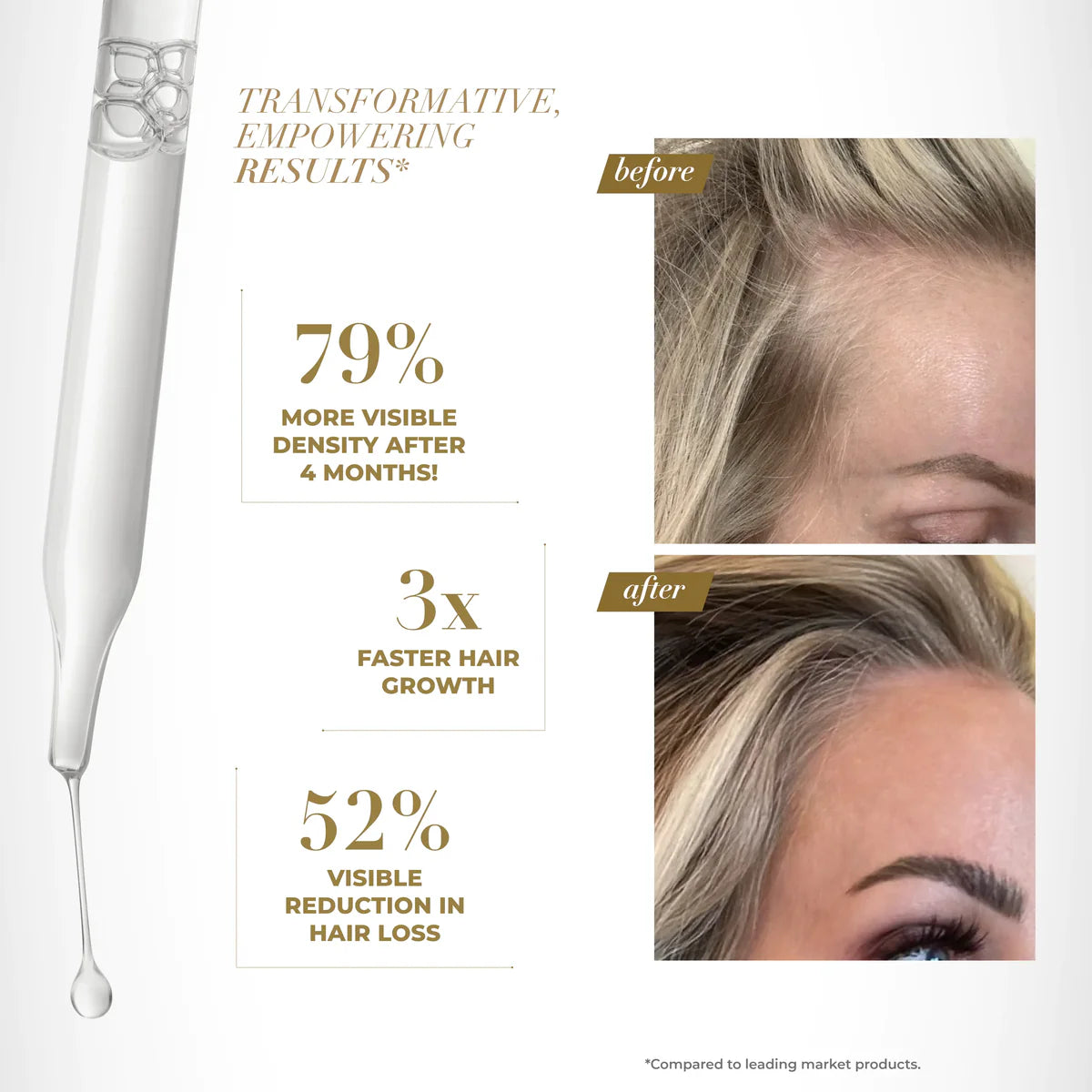 Goldie Locks | Scalp Serum