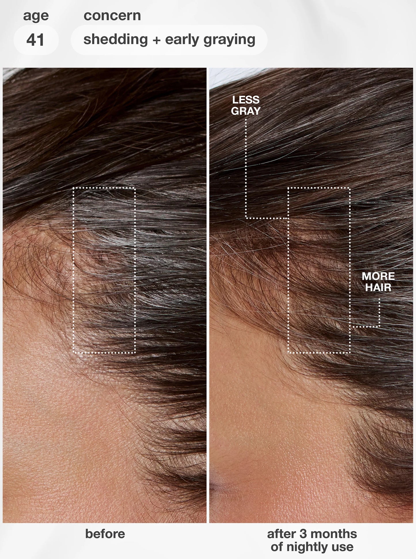K18 | FutureIQ™ biomimetic hair longevity serum