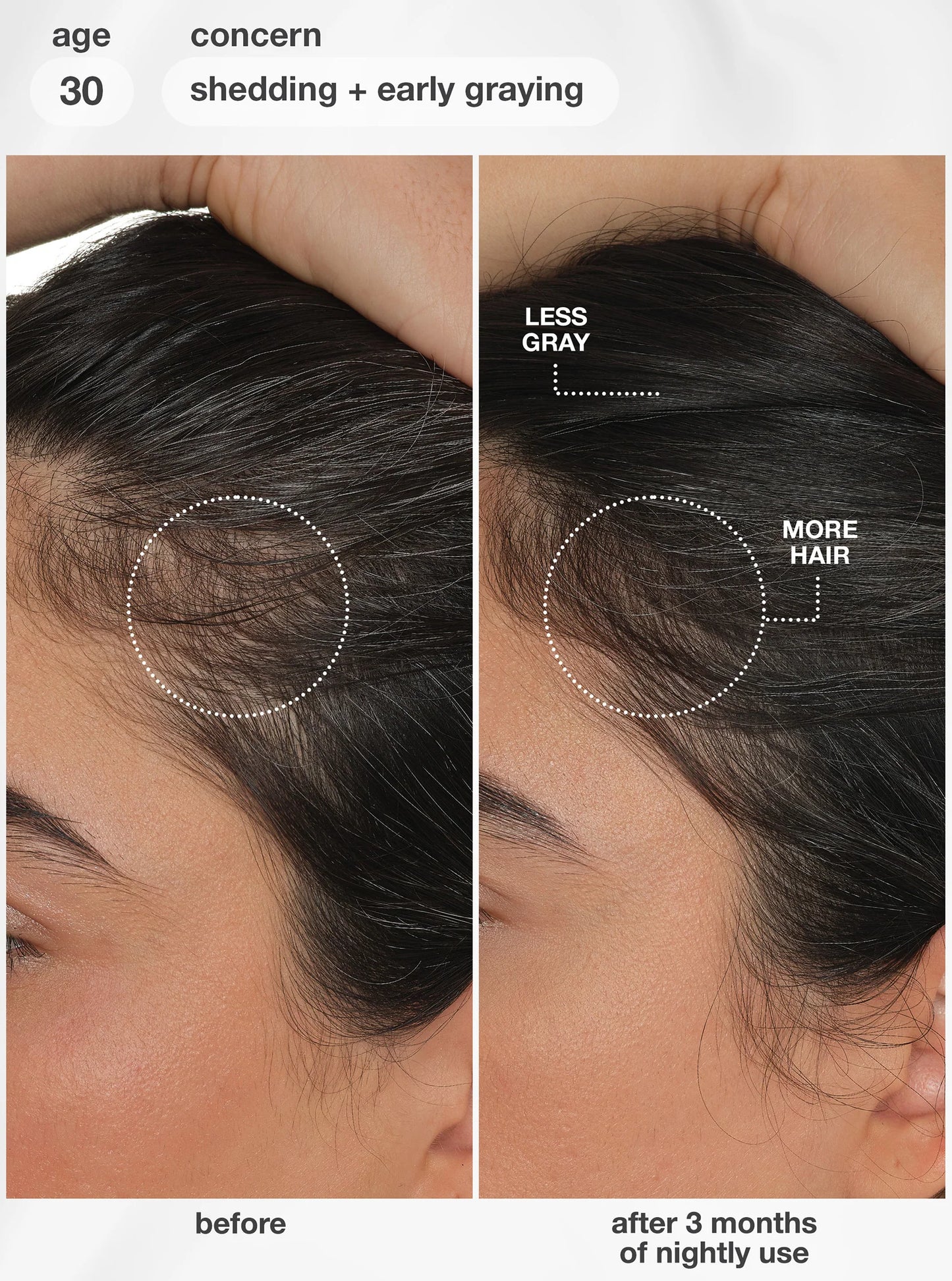 K18 | FutureIQ™ biomimetic hair longevity serum